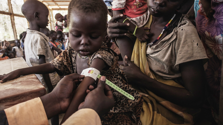 Action contre la Faim agit déjà dans les pays menacés par la famine. © Guy Calaf pour Action contre la Faim – Sud-Soudan